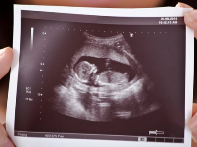 becf3f6ef6bb44168615425f33f65dd2